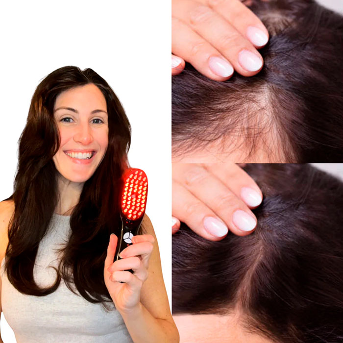 GrowthBrush, perie terapeutică 4 în 1 pentru păr - Image 6