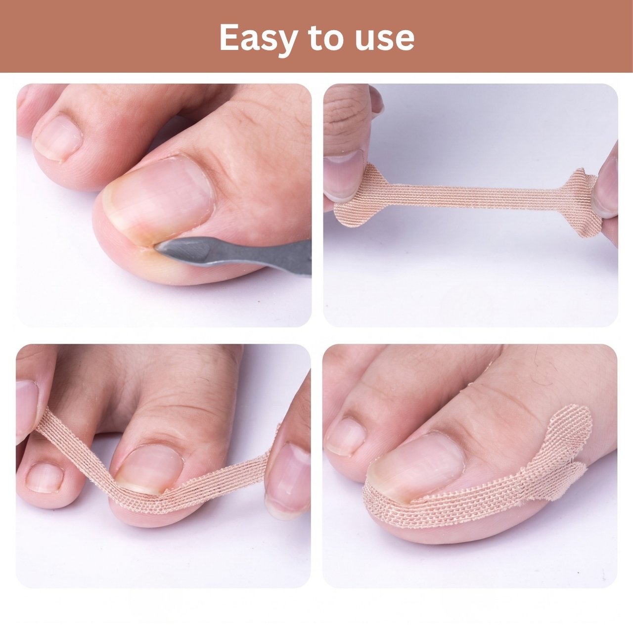 Plasturi pentru corectarea unghiilor încarnate, ProPatches - Image 9