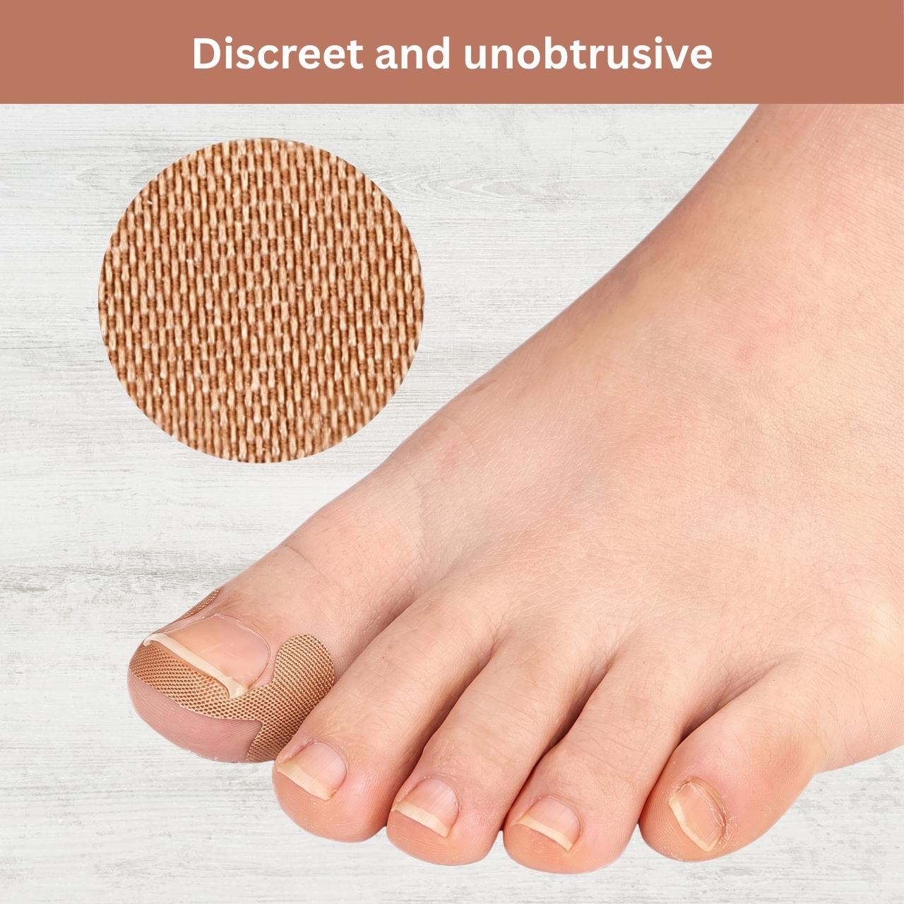Plasturi pentru corectarea unghiilor încarnate, ProPatches - Image 10