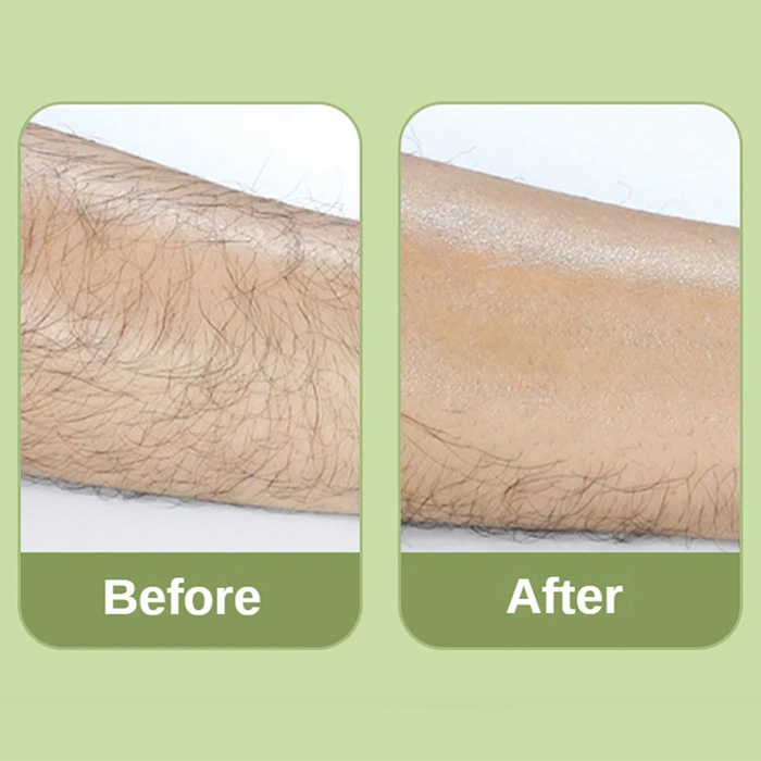 SoftSkin, un dispozitiv de îndepărtare a părului cu cristale care reduce părul și încetinește creșterea părului - Image 5
